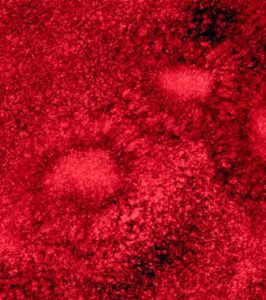 Contamination hotspots like this multi-species meat processing drain biofilm depicted by the rosette formation on stainless steel is the study target.
