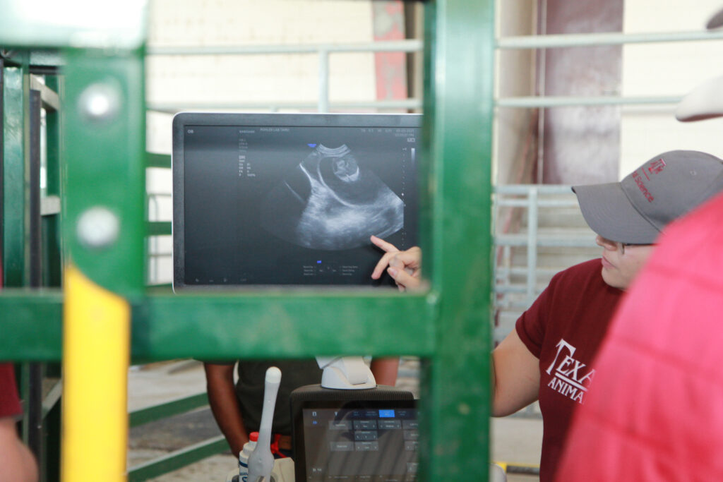 Person pointing at an ultrasound machine.